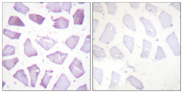 Immunohistochemistry analysis of paraffin-embedded human skeletal muscle, using PEA-15 (Phospho-Ser116) Antibody. The picture on the right is blocked with the phospho peptide.