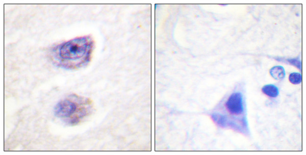 Immunohistochemistry analysis of paraffin-embedded human brain, using Tyrosine Hydroxylase (Phospho-Ser8) Antibody. The picture on the right is blocked with the phospho peptide.