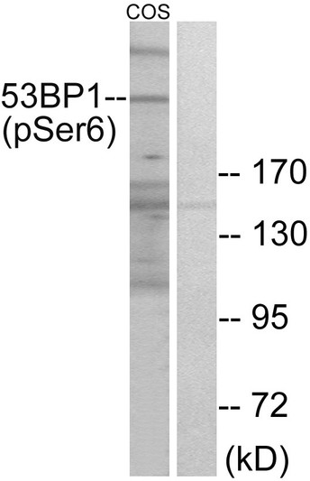 Western blot analysis of lysates from COS7 cells treated with insulin 0.01U/ML 15', using 53BP1 (Phospho-Ser6) Antibody. The lane on the right is blocked with the phospho peptide.