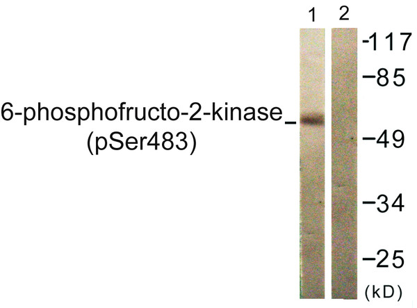 Western blot analysis of lysates from 293 cells treated with Heat shock, using PFKFB2 (Phospho-Ser483) Antibody. The lane on the right is blocked with the phospho peptide.