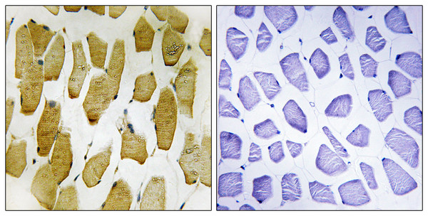 Immunohistochemistry analysis of paraffin-embedded human skeletal muscle, using Arachidonate 5 Lipoxygenase (Phospho-Ser271) Antibody. The picture on the right is blocked with the phospho peptide.