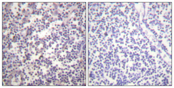 Immunohistochemistry analysis of paraffin-embedded human lymph node, using B-RAF (Phospho-Ser602) Antibody. The picture on the right is blocked with the phospho peptide.