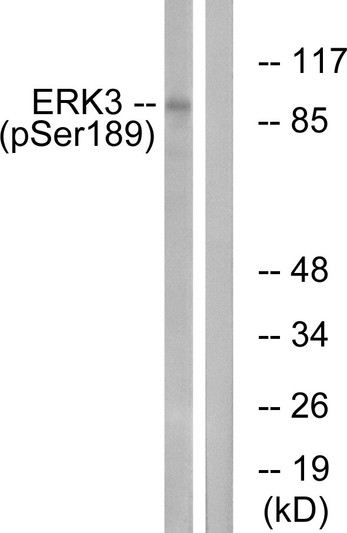 Western blot analysis of lysates from mouse brain, using ERK3 (Phospho-Ser189) Antibody. The lane on the right is blocked with the phospho peptide.