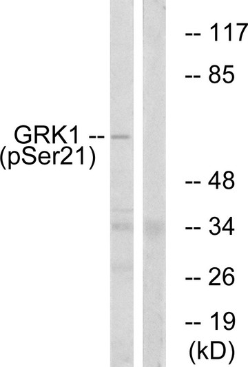 Western blot analysis of lysates from COS7 cells treated with TNF 20ng/ml 5', using GRK1 (Phospho-Ser21) Antibody. The lane on the right is blocked with the phospho peptide.