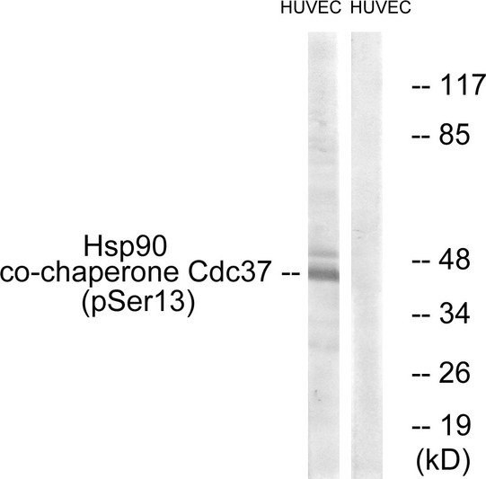 Western blot analysis of lysates from HUVEC cells, using CDC37 (Phospho-Ser13) Antibody. The lane on the right is blocked with the phospho peptide.