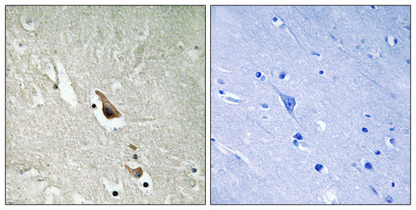 Immunohistochemistry analysis of paraffin-embedded human brain, using MAP3K7 (Phospho-Ser439) Antibody. The picture on the right is blocked with the phospho peptide.