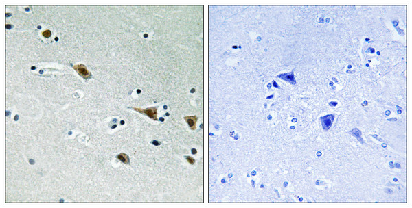 Immunohistochemistry analysis of paraffin-embedded human brain, using MAP2K7 (Phospho-Ser271) Antibody. The picture on the right is blocked with the phospho peptide.