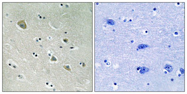 Immunohistochemistry analysis of paraffin-embedded human brain, using PAK1 (Phospho-Ser204) Antibody. The picture on the right is blocked with the phospho peptide.
