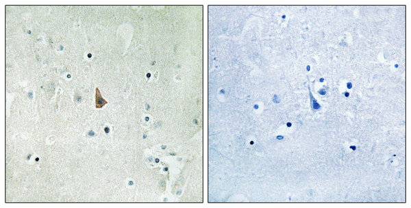 Immunohistochemistry analysis of paraffin-embedded human brain, using Trk C (Phospho-Tyr516) Antibody. The picture on the right is blocked with the phospho peptide.