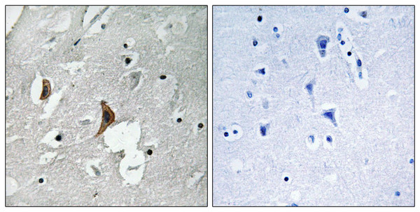 Immunohistochemistry analysis of paraffin-embedded human brain, using NMDAR2B (Phospho-Tyr1336) Antibody. The picture on the right is blocked with the phospho peptide.