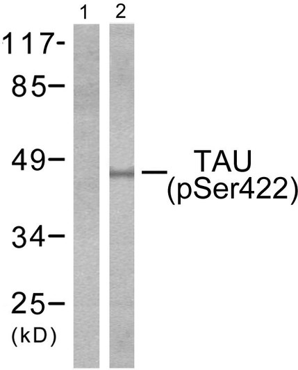 Western blot analysis of lysates from mouse brain, using Tau (Phospho-Ser422) Antibody. The lane on the left is blocked with the phospho peptide.
