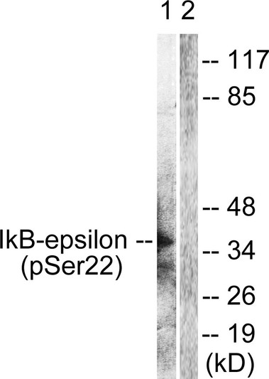Western blot analysis of lysates from Jurkat cells treated with TNF-a 20ng/ml 30', using IkappaB-epsilon (Phospho-Ser22) Antibody. The lane on the right is blocked with the phospho peptide.