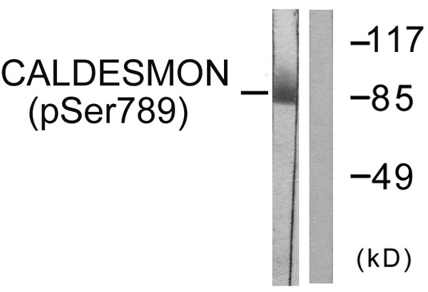 Western blot analysis of lysates from HeLa cells treated with EGF 200ng/ml 30', using Caldesmon (Phospho-Ser789) Antibody. The lane on the right is blocked with the phospho peptide.