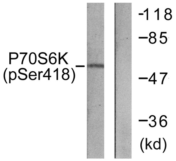 Western blot analysis of lysates from HT29 cells treated with serum 20% 15', using p70 S6 Kinase (Phospho-Ser418) Antibody. The lane on the right is blocked with the phospho peptide.