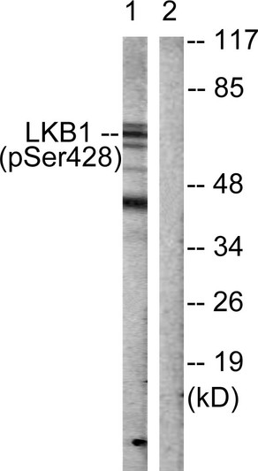 Western blot analysis of lysates from HeLa cells treated with PMA 125ng/ml 30', using LKB1 (Phospho-Ser428) Antibody. The lane on the right is blocked with the phospho peptide.