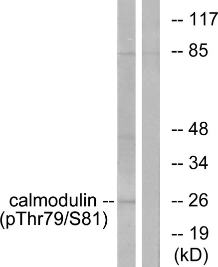 Western blot analysis of lysates from Jurkat cells treated with Insulin 0.01U/ml 15', using Calmodulin (Phospho-Thr79+Ser81) Antibody. The lane on the right is blocked with the phospho peptide.