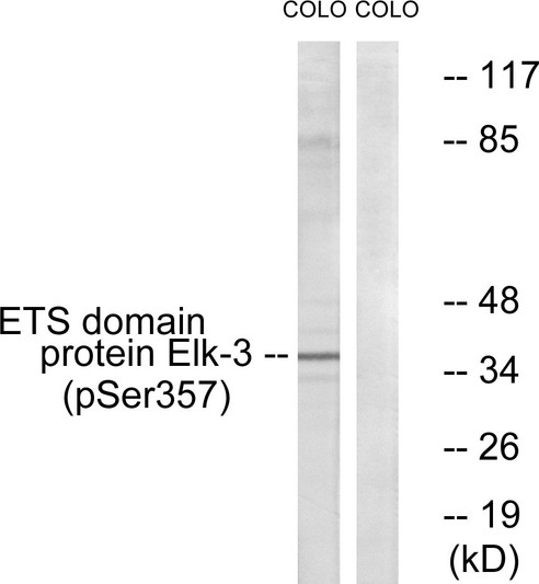 Western blot analysis of lysates from COLO205 cells treated with serum 20% 15', using Elk3 (Phospho-Ser357) Antibody. The lane on the right is blocked with the phospho peptide.