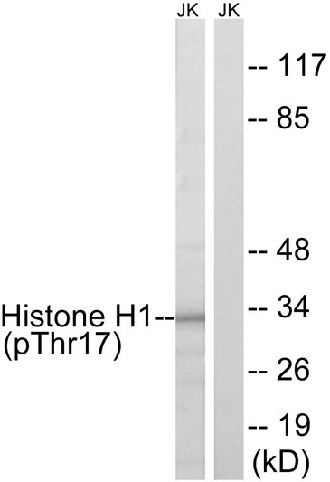 Western blot analysis of lysates from Jurkat cells treated with UV 15', using Histone H1 (Phospho-Thr17) Antibody. The lane on the right is blocked with the phospho peptide.