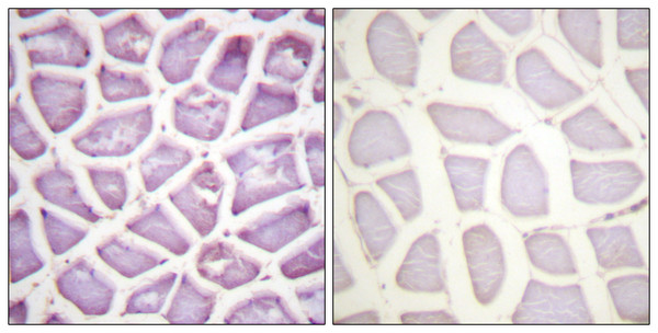 Immunohistochemistry analysis of paraffin-embedded human skeletal muscle, using Parkin (Phospho-Ser131) Antibody. The picture on the right is blocked with the phospho peptide.