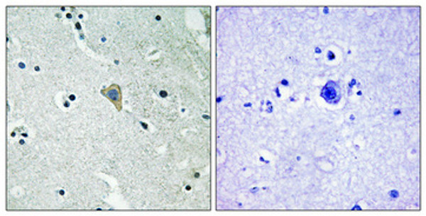 Immunohistochemical analysis of paraffin-embedded Human brain. Antibody was diluted at 1:100 (4°C overnight). High-pressure and temperature Tris-EDTA, pH8.0 was used for antigen retrieval. Negetive contrl (right) obtaned from antibody was pre-absorbed by immunogen peptide.