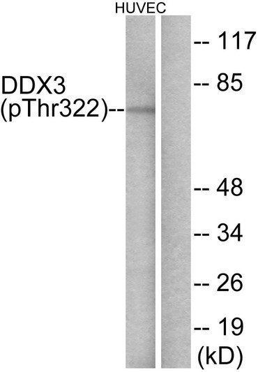 Western blot analysis of DDX3/DEAD-box Protein 3 (Phospho-Thr322) Antibody. The lane on the right is blocked with the DDX3/DEAD-box Protein 3 (Phospho-Thr322) peptide.