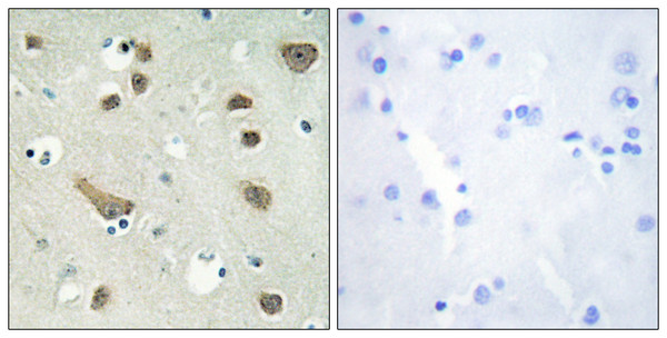 Immunohistochemistry analysis of paraffin-embedded human brain tissue, using 14-3-3 gamma Antibody. The picture on the right is blocked with the synthesized peptide.