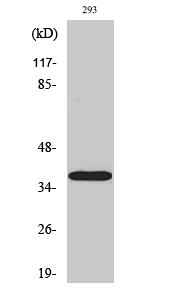 Western Blot analysis of various cells using 17β-HSD11 Polyclonal Antibody STJ91378