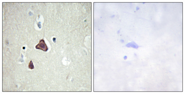 Immunohistochemistry analysis of paraffin-embedded human brain tissue, using ADCY8 Antibody. The picture on the right is blocked with the synthesized peptide. Immunohistochemistry analysis of paraffin-embedded human brain tissue, using ADCY8 Antibody. The picture on the right is blocked with the synthesized peptide.