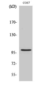 Western Blot analysis of various cells using AAK1 Polyclonal Antibody STJ91403