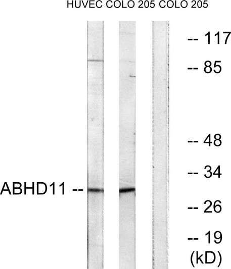 Western blot analysis of lysates from COLO and HUVEC cells, using ABHD11 Antibody. The lane on the right is blocked with the synthesized peptide.