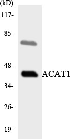 Western blot analysis of the lysates from HepG2 cells using ACAT1 antibody.