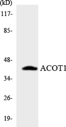 Western blot analysis of the lysates from HT-29 cells using ACOT1 antibody.