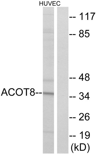 Western blot analysis of lysates from HUVEC cells, using ACOT8 Antibody. The lane on the right is blocked with the synthesized peptide.
