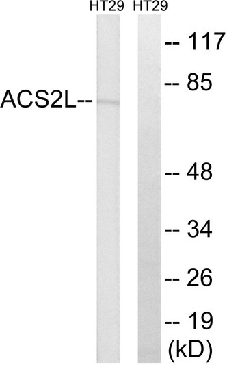 Western blot analysis of lysates from HT-29 cells, using ACSS1 Antibody. The lane on the right is blocked with the synthesized peptide. Western blot analysis of lysates from HT-29 cells, using ACSS1 Antibody. The lane on the right is blocked with the synthesized peptide.