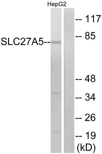 Western blot analysis of lysates from HepG2 cells, using SLC27A5 Antibody. The lane on the right is blocked with the synthesized peptide.