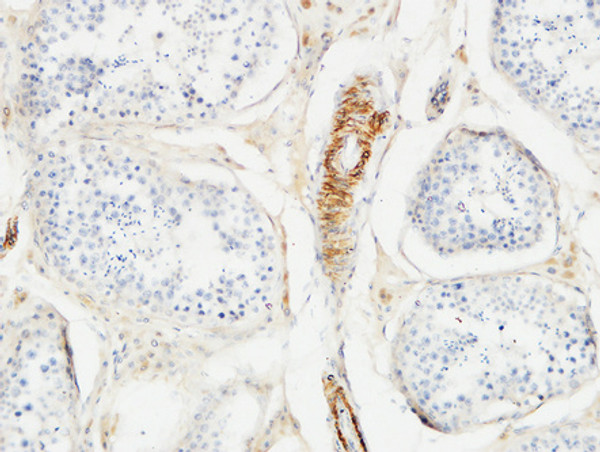 Immunohistochemical analysis of paraffin-embedded Human testis. 1, Antibody was diluted at 1:100 (4°C overnight). 2, High-pressure and temperature EDTA, pH8.0 was used for antigen retrieval. 3, Secondary antibody was diluted at 1:200 (room temperature, 30min).