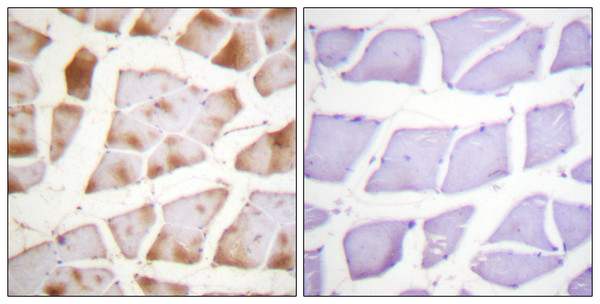 Immunohistochemistry analysis of paraffin-embedded human skeletal muscle tissue, using Actin-pan Antibody. The picture on the right is blocked with the synthesized peptide.
