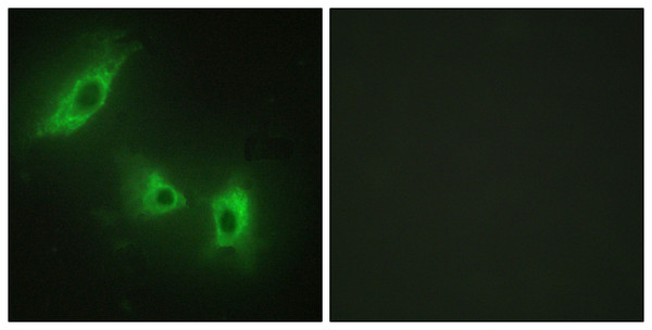 Immunofluorescence analysis of HeLa cells, using ACV1B Antibody. The picture on the right is blocked with the synthesized peptide.