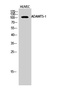 Western blot analysis of HUVEC cells using ADAMTS-1 Polyclonal Antibody