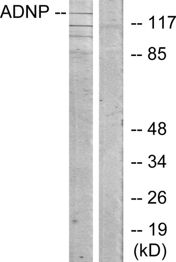 Western blot analysis of lysates from LOVO cells, using ADNP Antibody. The lane on the right is blocked with the synthesized peptide.