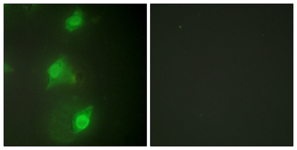 Immunofluorescence analysis of HeLa cells, using AIRE Antibody. The picture on the right is blocked with the synthesized peptide.