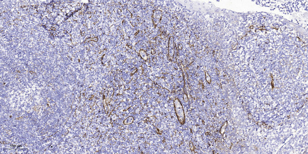 Immunohistochemical analysis of paraffin-embedded human tonsil. 1, Tris-EDTA, pH 9.0 was used for antigen retrieval. 2, STJ91520