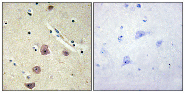 Immunohistochemistry analysis of paraffin-embedded human brain tissue, using AK5 Antibody. The picture on the right is blocked with the synthesized peptide.