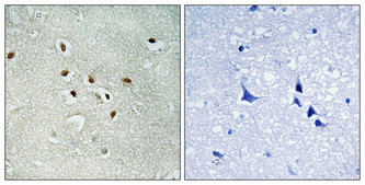 Immunohistochemical analysis of paraffin-embedded Human brain. Antibody was diluted at 1:100 (4°C overnight). High-pressure and temperature Tris-EDTA, pH8.0 was used for antigen retrieval. Negetive contrl (right) obtaned from antibody was pre-absorbed by immunogen peptide.