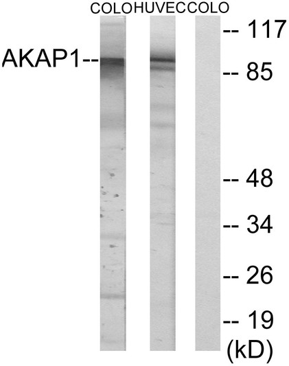 Western blot analysis of lysates from HUVEC and COLO cells, using AKAP1 Antibody. The lane on the right is blocked with the synthesized peptide. Western blot analysis of lysates from HUVEC and COLO cells, using AKAP1 Antibody. The lane on the right is blocked with the synthesized peptide.