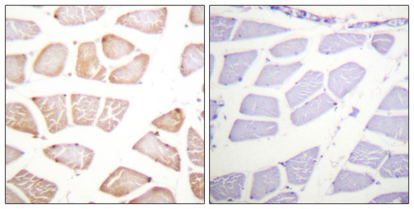 Immunohistochemistry analysis of paraffin-embedded human skeletal muscle tissue, using Akt Antibody. The picture on the right is blocked with the synthesized peptide.
