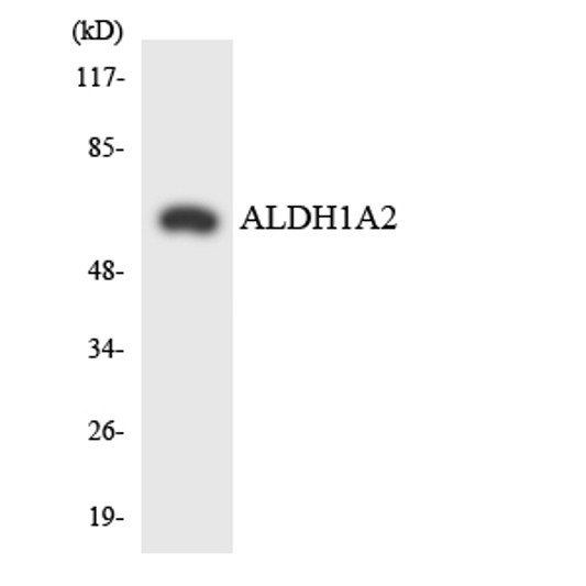 Western blot analysis of the lysates from COLO205 cells using ALDH1A2 antibody.