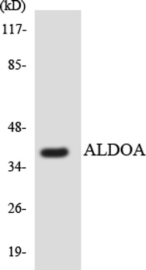 Western blot analysis of the lysates from HT-29 cells using ALDOA antibody. Western blot analysis of the lysates from HT-29 cells using ALDOA antibody.