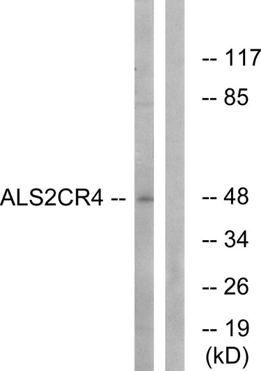Western blot analysis of lysates from Jurkat cells, using ALS2CR4 Antibody. The lane on the right is blocked with the synthesized peptide. Western blot analysis of lysates from Jurkat cells, using ALS2CR4 Antibody. The lane on the right is blocked with the synthesized peptide.