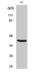 Western Blot analysis of various cells using ALX3 Polyclonal Antibody on cells' nuclei extracted by Minute™ Cytoplasmic STJ91572